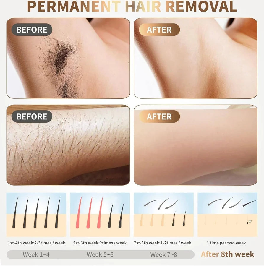 IPL Laser Hair Removal Device – Painless Permanent Hair Removal at Home.